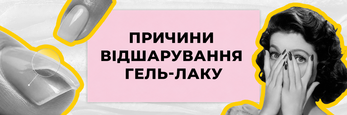 Чому відшаровується гель-лак через кілька днів: причини та як продовжити стійкість манікюру