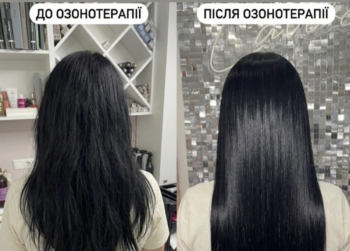 Озонотерапія волосся в Lavika — результат після процедури
